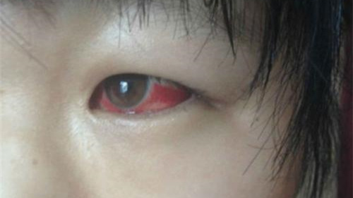 光觸媒除甲醛保護(hù)新裝修教室空氣，更保護(hù)孩子們